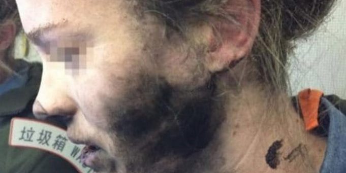 Apple odmítl odškodnit australskou ženu, po explozi sluchátek Beats v letadle