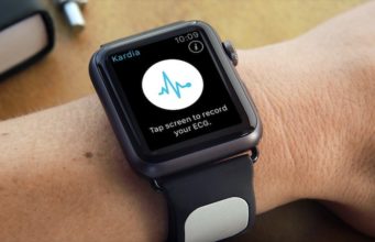 Apple pracuje na novém typu displejů pro Apple Watch