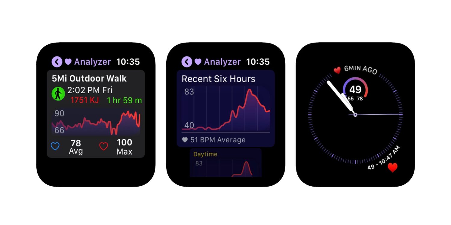 aplikace-heart-analyzer-pro-apple-watch-byla-kompletn-p-epracov-na