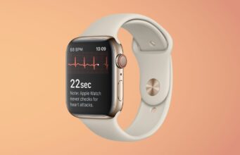 Návod – Jak zobrazit historii srdečního tepu na Apple Watch a iPhonu