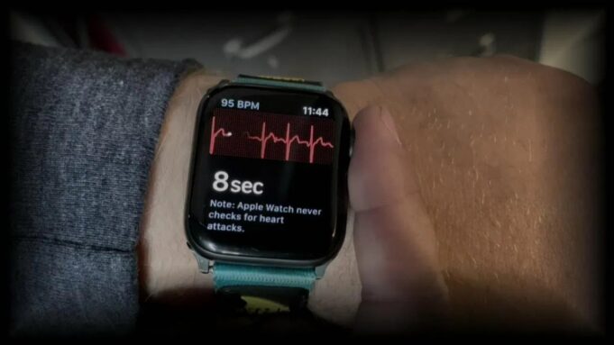Výzkumníci z Mayo Clinic dokázali použít EKG z Apple Watch k detekci slabé srdeční pumpy
